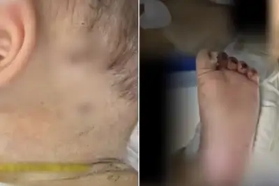 thumbnail - “10개월 아기 몸에 바늘 자국 600개” 엄마가 찔렀다…‘충격 이유’ 中 공분