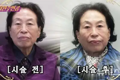 thumbnail - 전원주 “20년 젊어지는 시술받아”…모두가 놀란 얼굴 변화