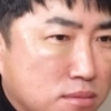47살 장동민이 받은 이 시술 “귀·코·눈 뚫고 당겨…너무 아파”