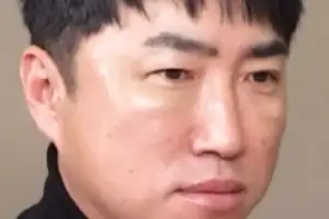 thumbnail - 47살 장동민이 받은 이 시술 “귀·코·눈 뚫고 당겨…너무 아파”