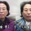 87세 전원주, 피부시술에 500만원 쓰더니