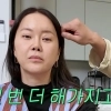 “‘이곳’ 성형했다 망했다” 백지영, 상태 어떻길래… ‘수술비 10억설’엔
