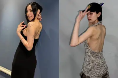 thumbnail - 나나, ‘타투’ 싹 다 지운 근황…“흉도 안 남고 깨끗”