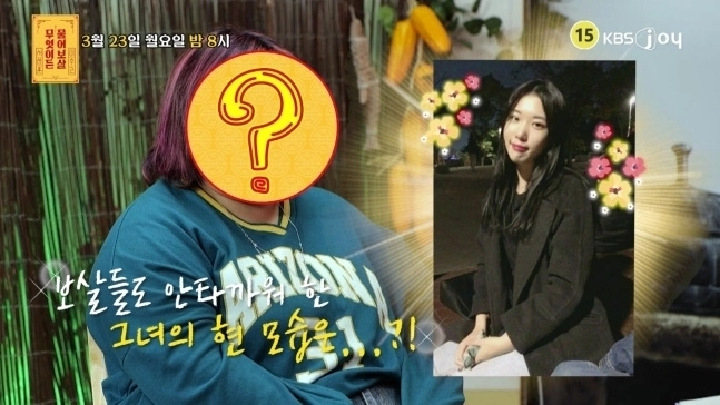 “신세경 닮았었는데” 80㎏ 넘게 살찐 20대 여성… 충격적 습관 있었다