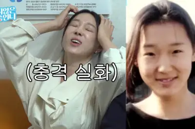 thumbnail - 이지혜, ‘인중축소술’ 했는데 어쩌나…안타까운 소식