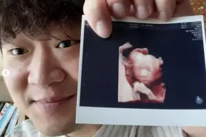 thumbnail - “아이가 생겼습니다”…정재형, 아들 사진 공개