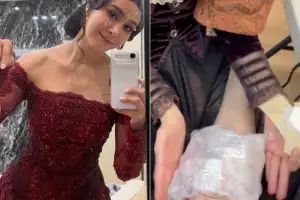 thumbnail - 옥주현, 공연 도중 부상… “크게 넘어져 못 일어났다”