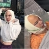 thumbnail - 핀란드 인플루언서 “韓서 안면윤곽 수술, 시력 상실 부작용”