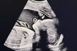 thumbnail - 송승현, 아빠 된다…초음파 사진 공개하며 “곧 만나자”