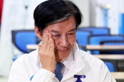 thumbnail - 조국, 눈 시퍼렇게 멍든 채 등장… 무슨 일?