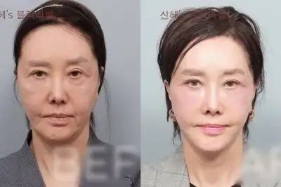 thumbnail - “젊어졌다 난리” 62세 유혜리, 확 달라진 외모…연예인 빠진 ‘안면거상’ 뭐길래