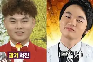 “성형전 얼굴 보인다”…박서진, ‘체중 11㎏’ 찐 최근 모습