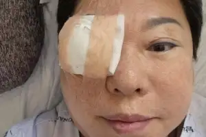 thumbnail - 양희은, 라디오서 안 보이더니…“각막이식” 안타까운 근황