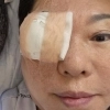 양희은, 라디오서 안 보이더니…“각막이식” 