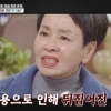 “입술 때문에 몰입 안돼” 일 끊긴 여배우…