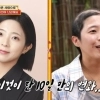 “10일만에 급성탈모” 33세 여성인데 ‘대
