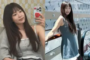 “과거 얼굴로 돌아가라”는 말에…성형 복원 후 미모 되찾은 여배우 근황