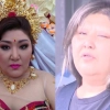 thumbnail - 입술 꿰매진 채 “살려달라”던 女…“바늘 주며 강요” 충격 전말