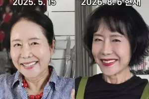 thumbnail - “눈까지 끌어올렸다”던 63세 윤영미, 확 달라진 외모…‘안면거상술’ 뭐길래
