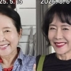“눈까지 끌어올렸다”던 63세 윤영미, 확 달라진 외모…‘안면거상술’ 뭐길래
