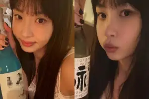 thumbnail - ‘앞트임 복원’ 강예원, 통통한 볼살에 달라진 분위기