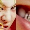 thumbnail - “지드래곤 치아도 남다르네” 다이아 ‘반짝’…멋지다고 따라했다간 ‘독’ 될 수도