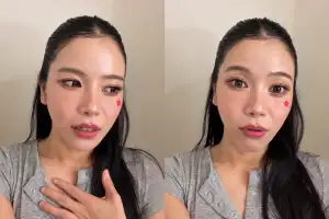 thumbnail - 마마무 솔라, 낯선 남성이 던진 의자에 부상…“욕하면서 다가와”