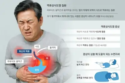 thumbnail - 추석 과식 후 ‘쓰린 속’... 잠들기 3시간 전엔 숟가락 놓으세요