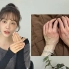 윤은혜, “손 붉어지더니 붓기 시작”…알고 보니 심각한 반응