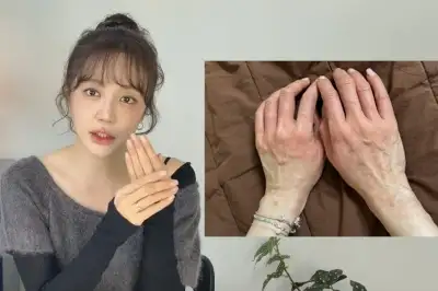 thumbnail - 윤은혜, “손 붉어지더니 붓기 시작”…알고 보니 심각한 반응