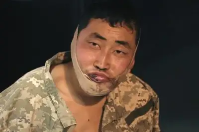 thumbnail - “항복하느니 죽겠다”…생포 북한군 ‘붕대 감은 턱’ 전말