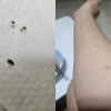 “부산 한 찜질방 갔다가 빈대 옮았다”…유튜버가 확인한 심각한 실태
