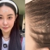 39살 여배우, “흑채 쓴다” 고백…‘탈모 고민’ 어느 정도길래