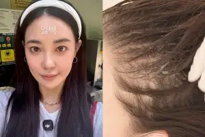 39살 여배우, “흑채 쓴다” 고백…‘탈모 고민’ 어느 정도길래