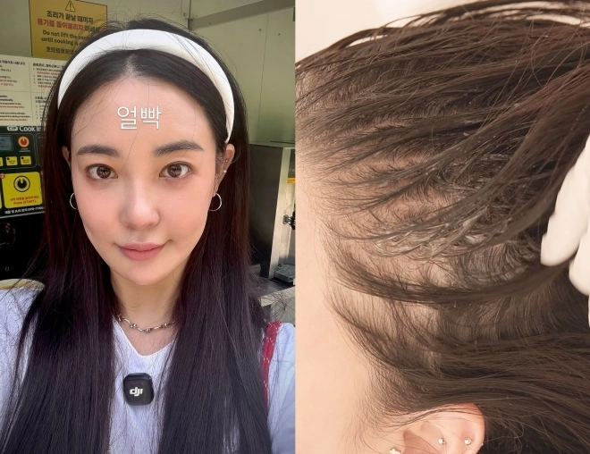 39살 여배우, “흑채 쓴다” 고백…‘탈모 고민’ 어느 정도길래