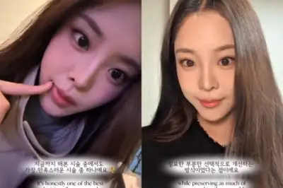 thumbnail - ‘미코 진’ 우지원 딸, ‘이 부위’ 시술했다…“가장 만족스러워”