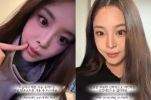 ‘미코 진’ 우지원 딸, ‘이 부위’ 시술했다…“가장 만족스러워”