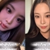 ‘미코 진’ 우지원 딸, ‘이 부위’ 시술했
