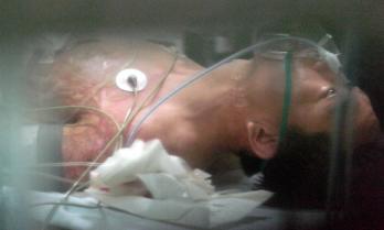 이대 목동병원에서 치료받고 있는 경찰 살해…