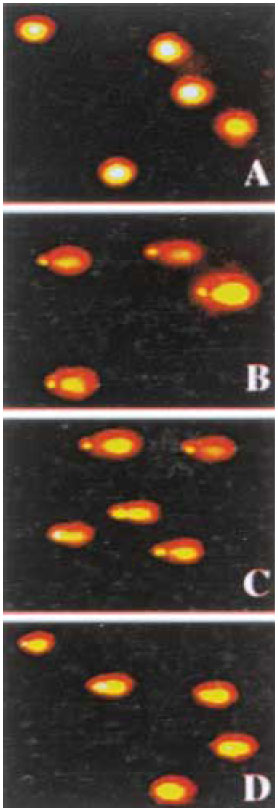 연구팀이 관찰한 ‘DNA 절단현상’. 미세먼지가 없는 배양액에서 관찰된 정상적인 DNA(사진A)는 동글동글한 편이지만, 연구대상 장소에서 포집한 미세먼지 추출물로 만든 배양액에선 잘려진 DNA가 두드러지게 관찰됐다.B는 교통혼잡지역,C는 주거지역 실외공기,D는 아파트 실내공기를 시료로 썼다. 한국환경독성학회지 제공
