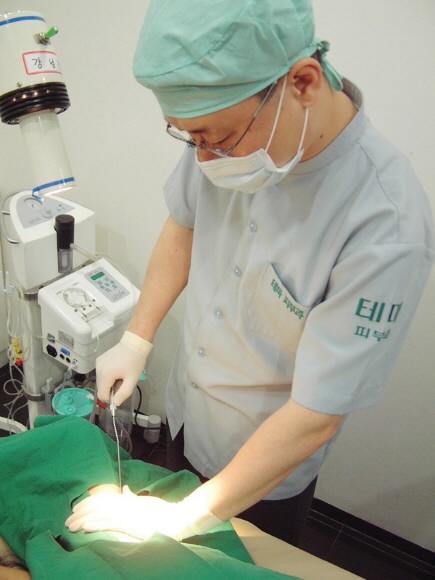 겨드랑이 다한증 치료를 위한 리포셋 흡입술 시술장면. 테마피부과 제공