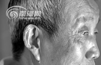 귀 옆에 검은 머리가 나고 있는 주궈룽씨.  남국도시보