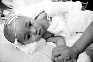 이식수술을 마친 뒤 안정을 취하고 있는 허위쉬안군. 심양만보