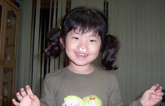 쌍코피가 나서 코를 막고 있어도 카메라만 들이대면 저렇게 좋아하네요. (문홍식·서울시 송파구 문정동)