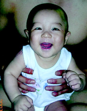     눈에 넣어도 안 아픈 조카