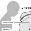 전립선암 ‘수술 합병증’은 없다
