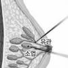 20~30대 여성도 유방암 마음 못 놓는다