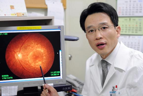 가톨릭대 강남성모병원 안과 이원기 교수가 황반변성 환자의 망막을 가리키며 증상을 설명하고 있다. 이호정기자 hojeong@seoul.co.kr