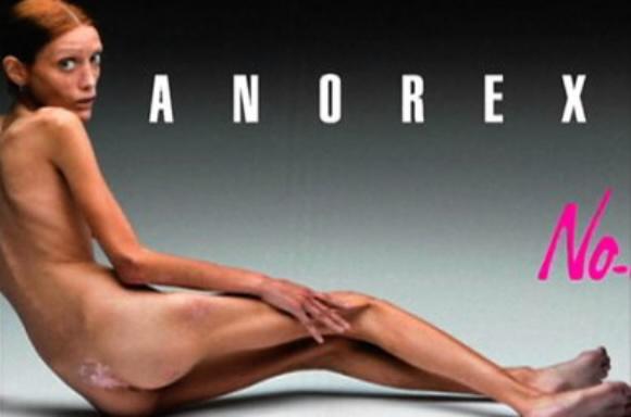 9일 거식증의 위험성을 경고하는 MBC 시사프로그램 ‘W’.