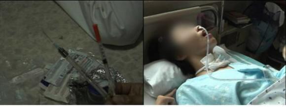 성형수술의 피해를 살펴보는 4일 KBS 2TV ‘추적60분’.